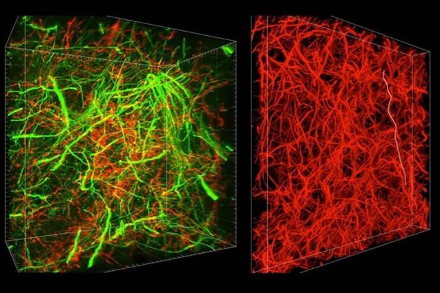 Imaging the Brain at Multiple Size Scales